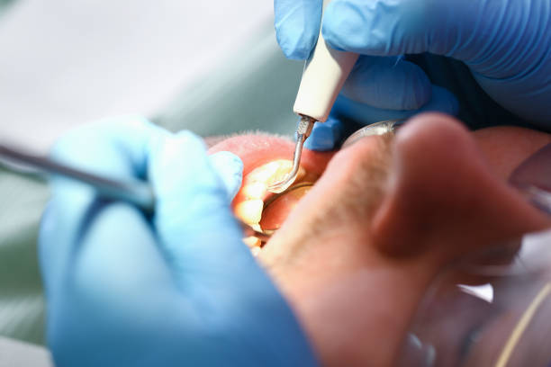 Best Pediatric Emergency Dentist in Lely, FL